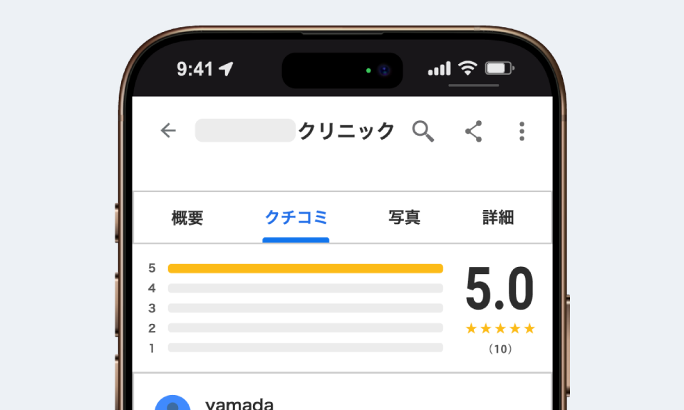 Google口コミ非表示対策